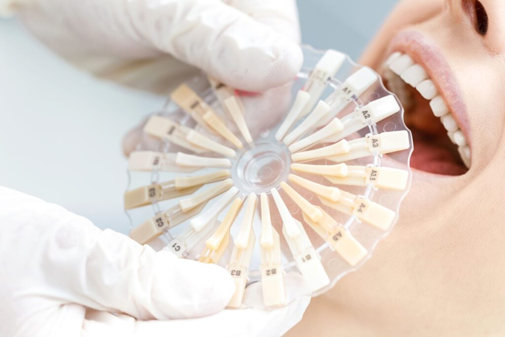 Stomatolog dobiera odpowiedni kolor implantów